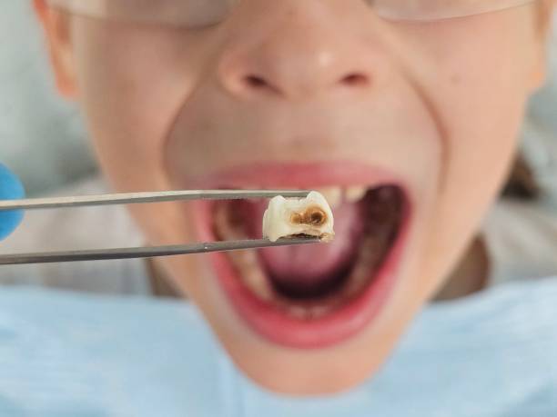 Best Urgent Dental Care for Toothache in Marshall, IL